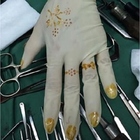 راهنمای خرید دستکش جراحی